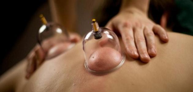 حجامة الدمام مركز الدواء للحجامة