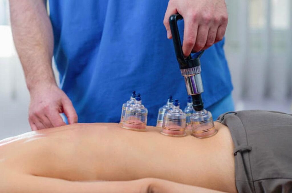 حجامة الدمام مركز الدواء للحجامة