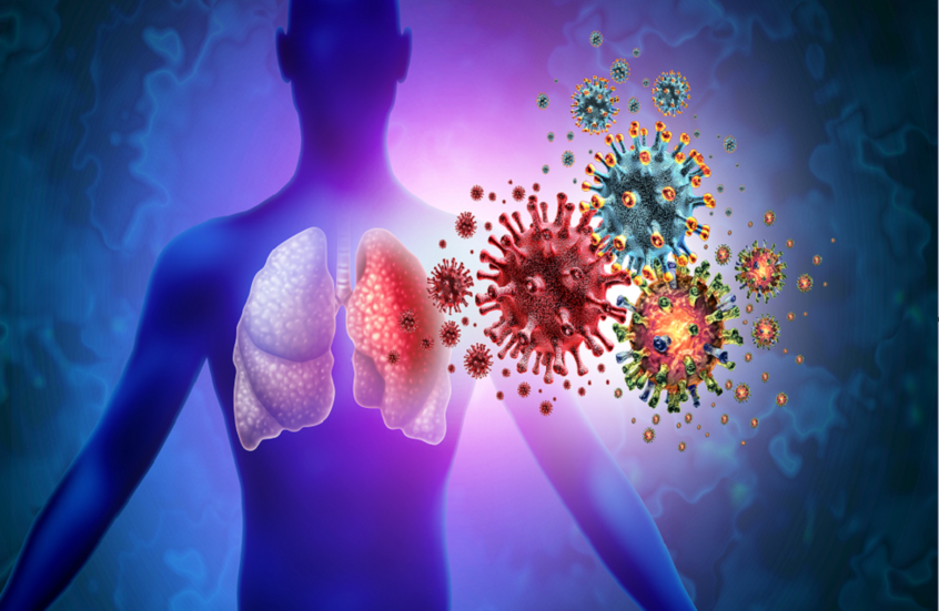 العدوى الجهازية الحادة