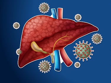 التهاب الكبد الوبائي الفيروسي (A – B – C)